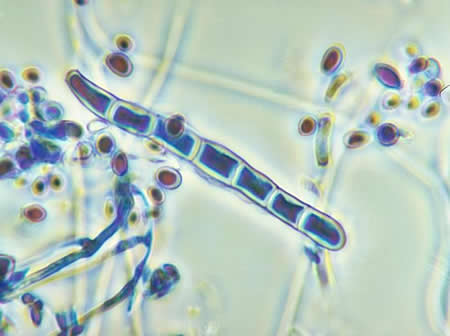 Fungal Microscopy