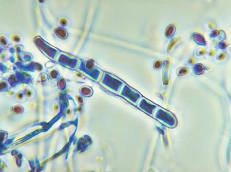 Fungal Microscopy Fungal Microscopy