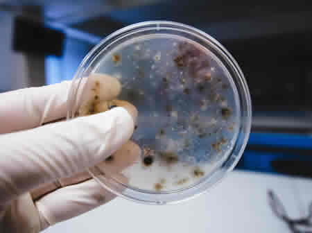 Fungal Microscopy Fungal Microscopy
